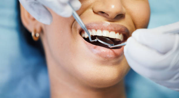 Best Emergency Treatment for Dental Infections or Abscesses in Mather, CA